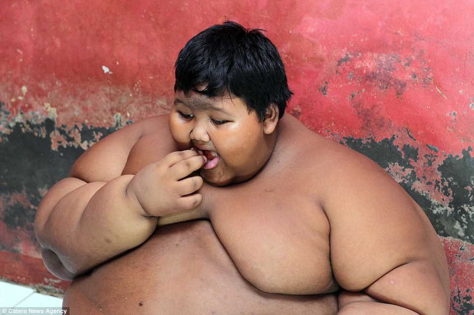 【画像】世界一デブな１０歳がこれ　体重192キロ