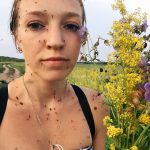 【画像】ロシアの女子「蚊に刺されたww(ﾊﾟｼｬｯ！！！」