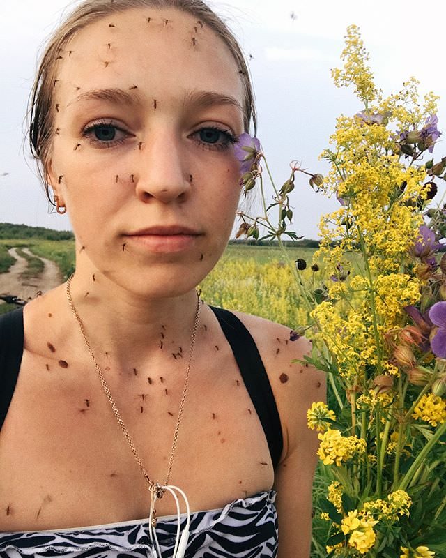 【画像】ロシアの女子「蚊に刺されたww(ﾊﾟｼｬｯ！！」