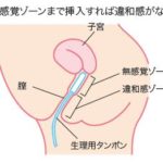 【画像】女の子のアソコ、全く感じないゾーンがあるらしいｗｗ