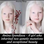 【画像】ロシアで生まれたアルビノと虹彩異色症を持った少女、ガチで神秘的過ぎるｗ
