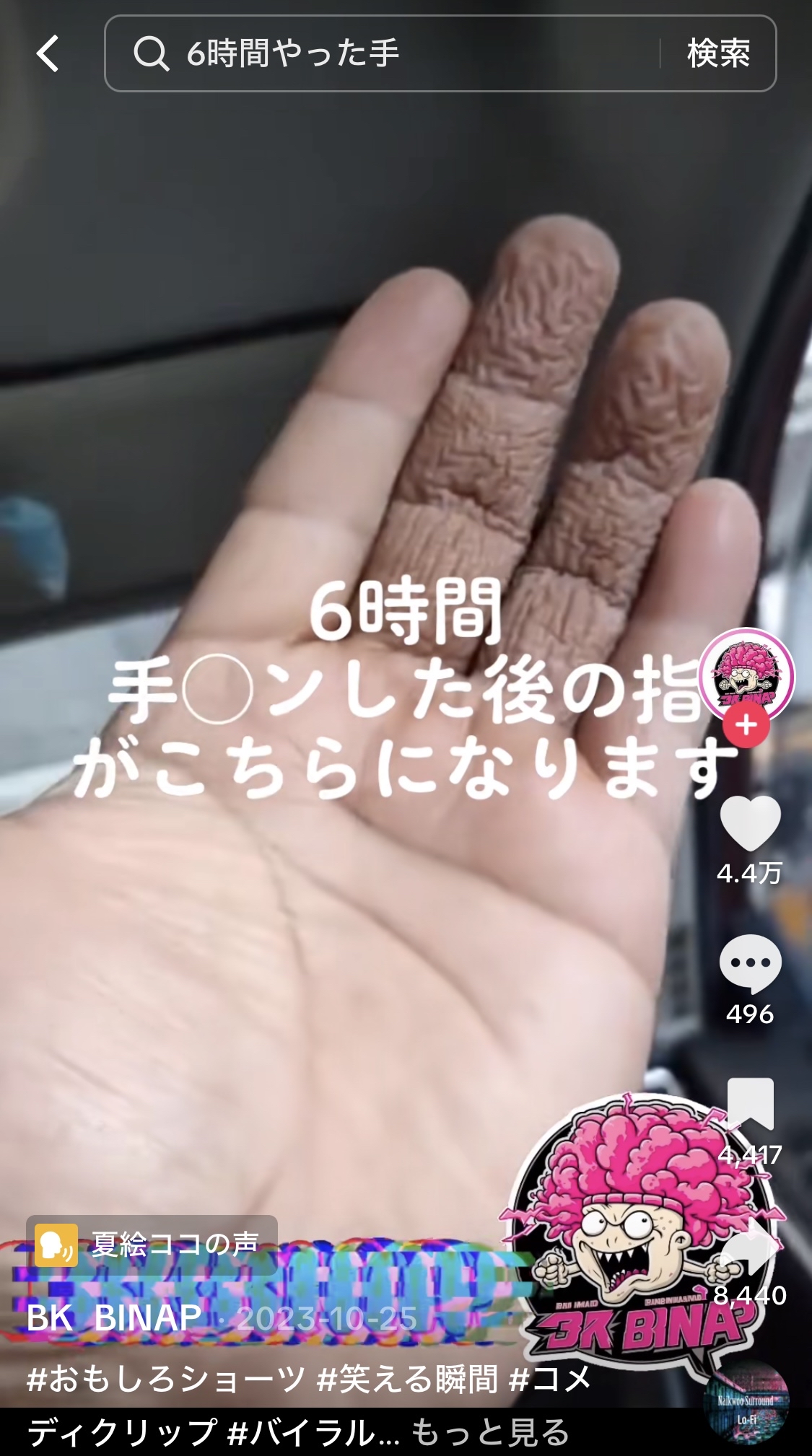 【画像】6時間手マンをした男の指が凄い